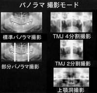 デジタルパノラマの導入